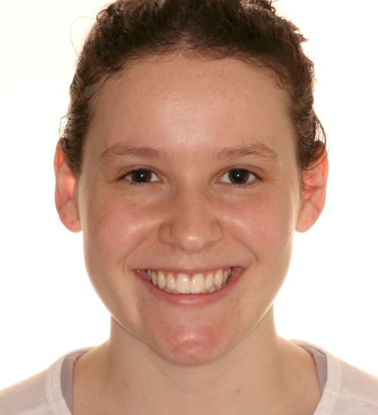 Cassidy after treatment