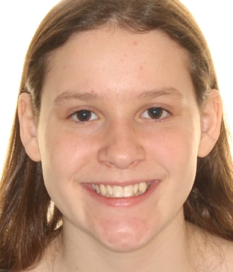 Cassidy before treatment