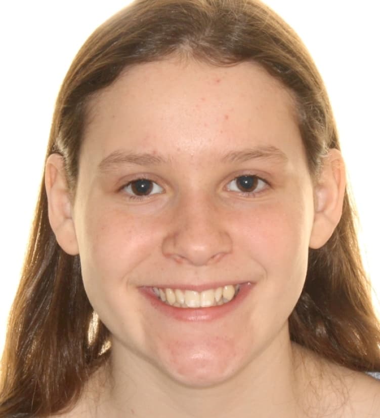 Cassidy before treatment