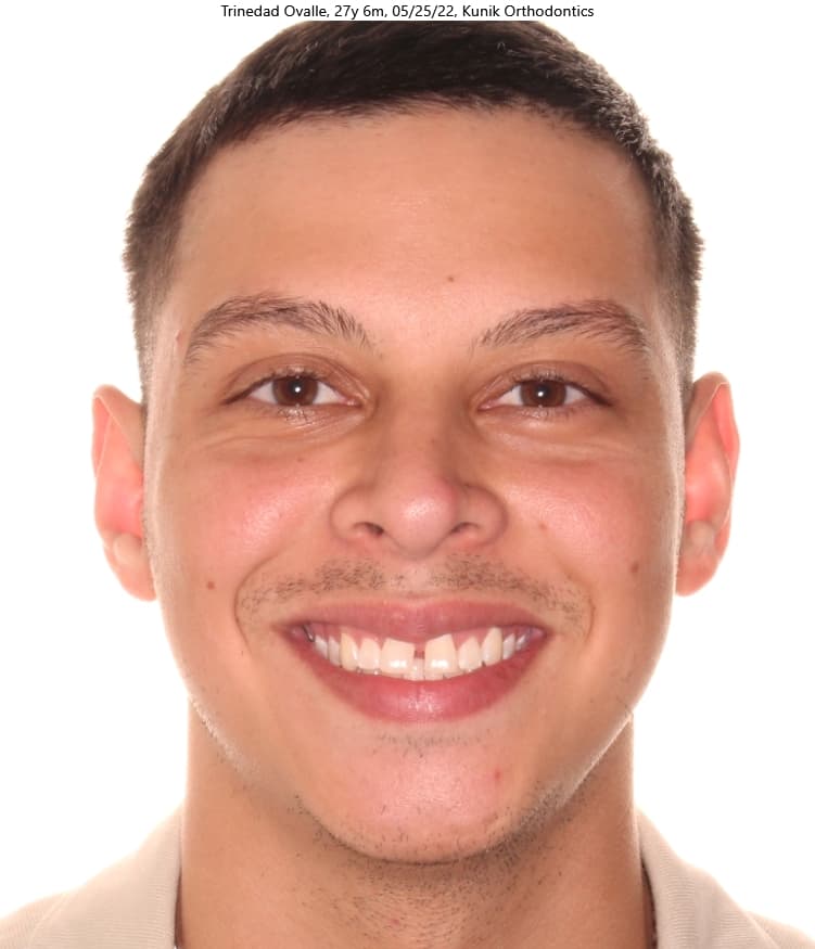 Trinidad before treatment