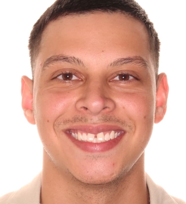 Trinidad before treatment