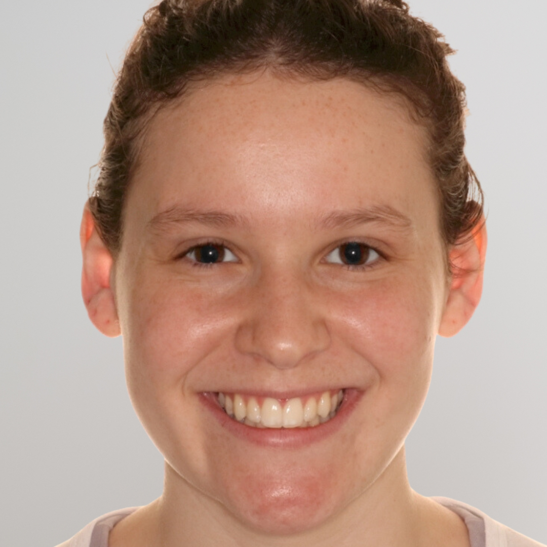 Professional Invisalign in Austin TX with minimal office visits and fast results.