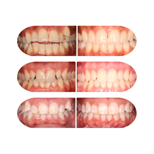 Affordable orthodontic care in Austin TX without compromising quality.