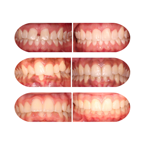 Orthodontist in Austin TX creating custom treatment plans for every smile.