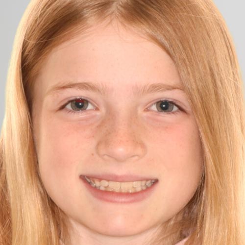 Austin braces specialist providing custom treatment for children and adults.