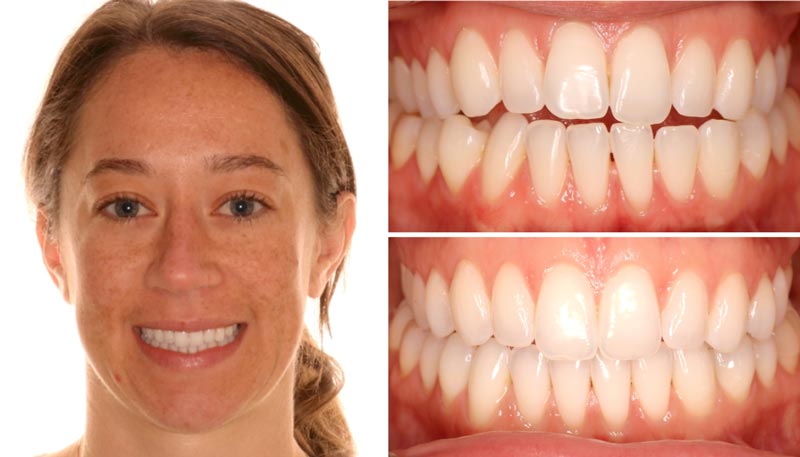 Austin’s trusted orthodontic provider for braces and clear aligners.