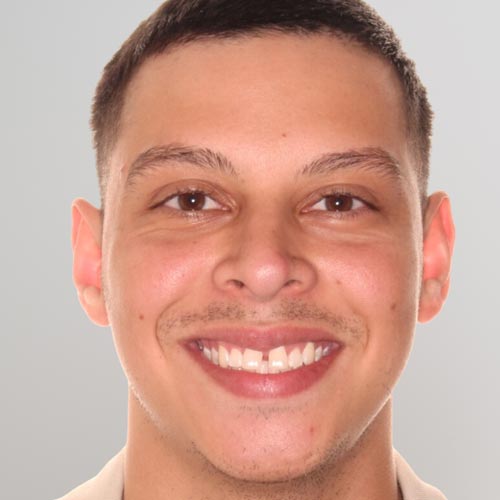 Invisalign cost Austin estimates available with complimentary consultations.