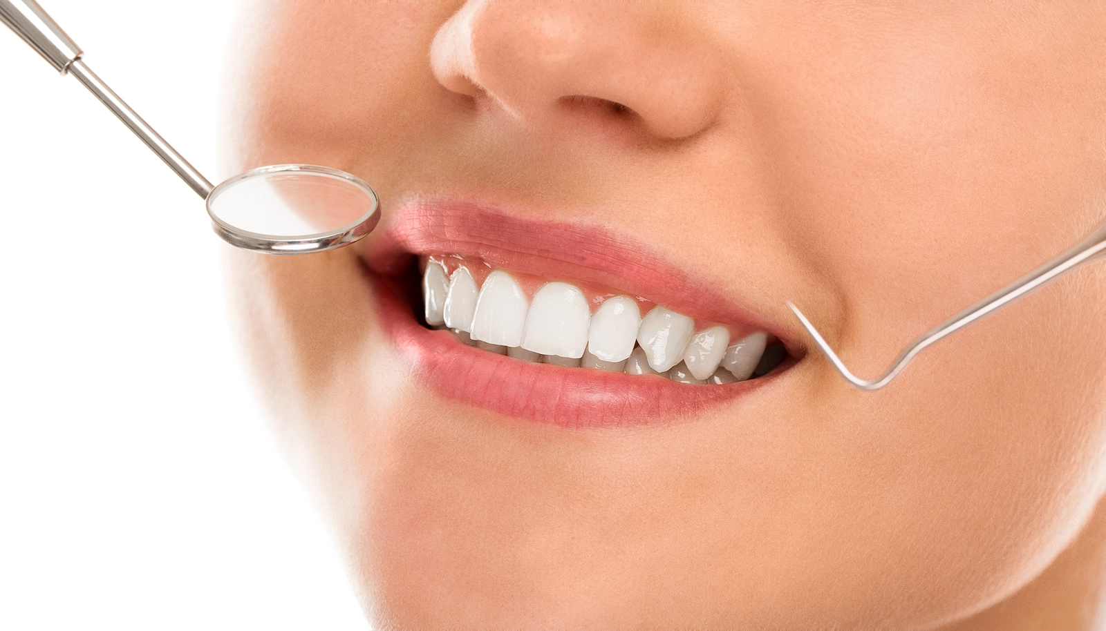 Capped Teeth vs. Veneers