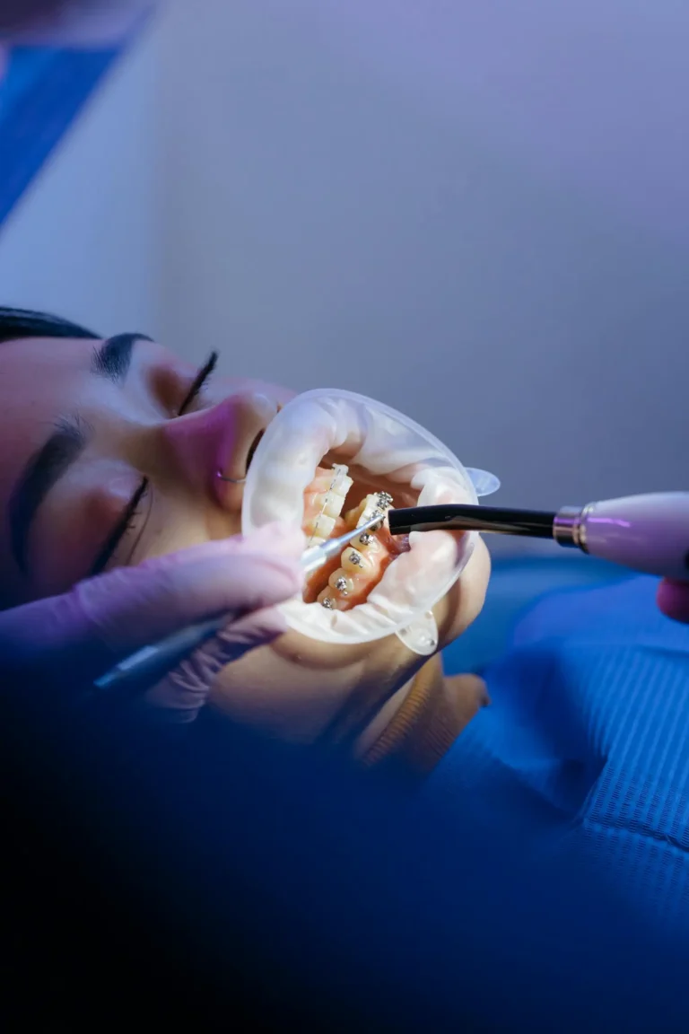 Orthodontic Emergencies: When Should I Call An Orthodontist?