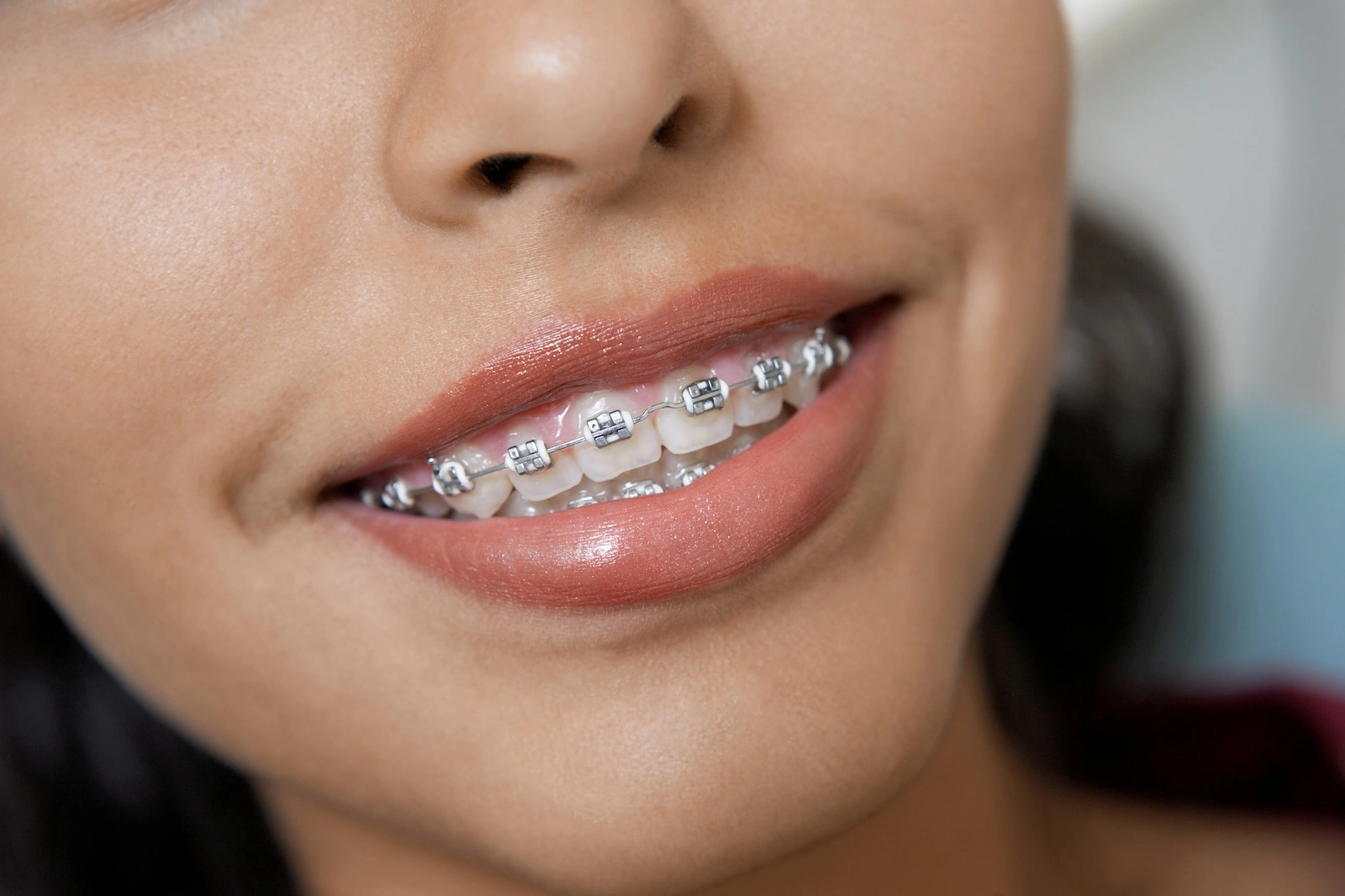 smiling girl with braces on her teeth