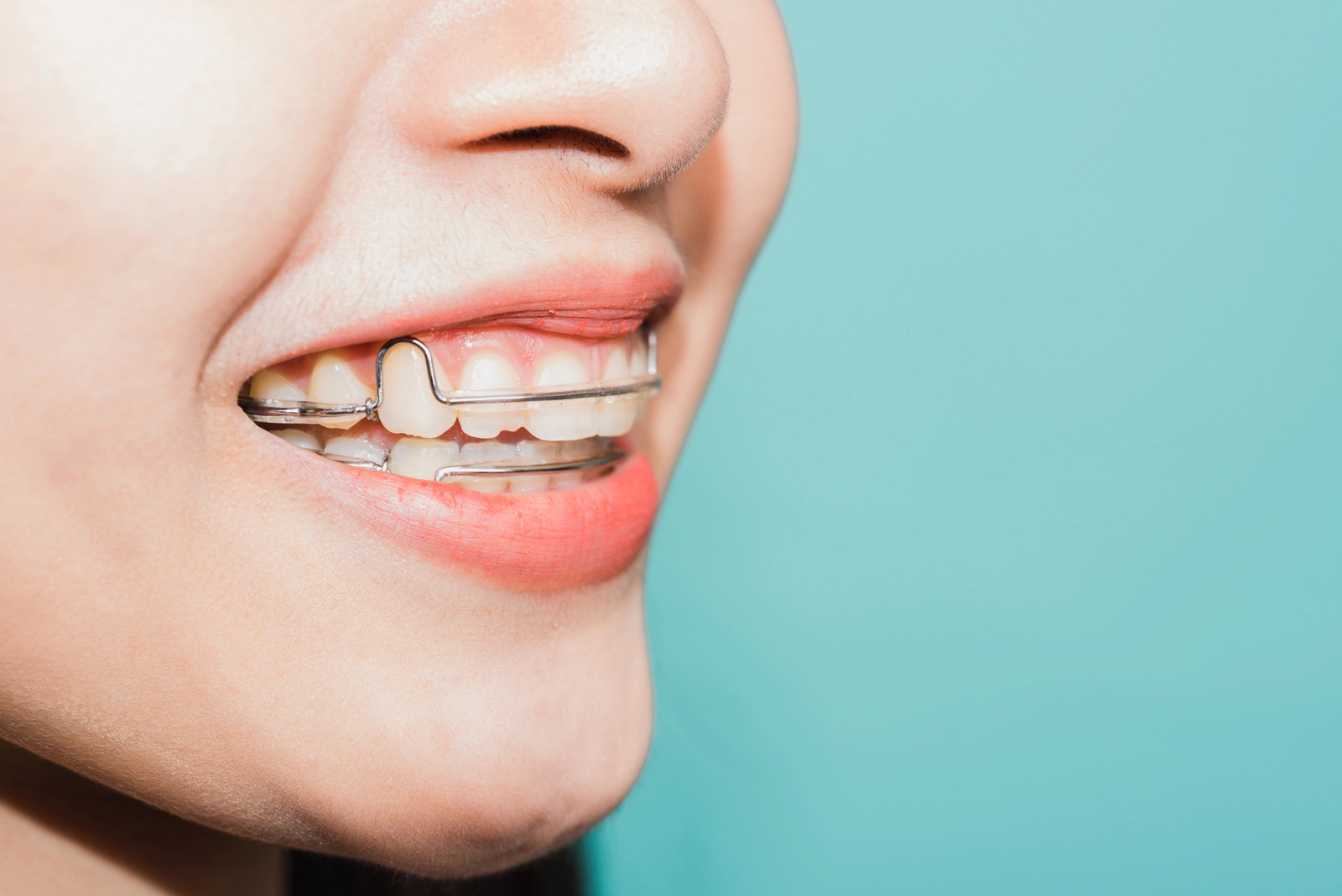What Problems Do Orthodontists Fix?