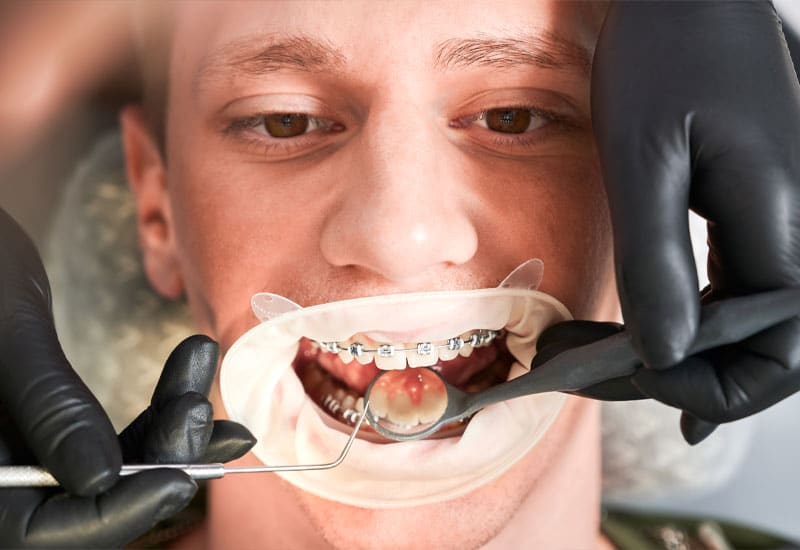 A dental professional examining a patient's mouth