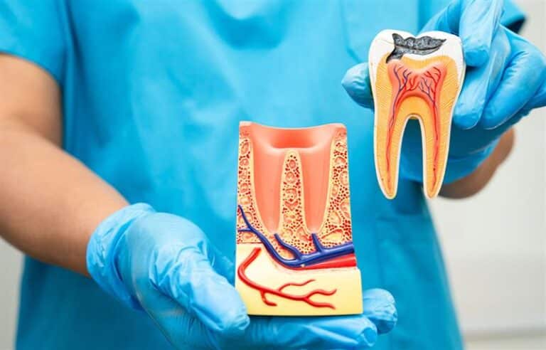 What Are the Main Causes of Cavities?