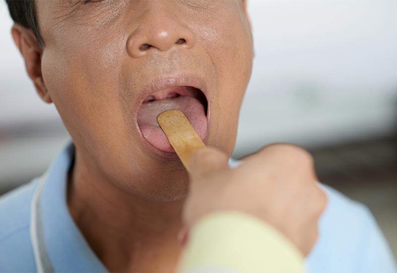 Potential-Causes-of-Tongue-Pain