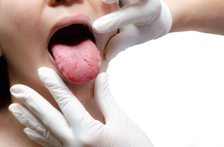 Why Does the Side of My Tongue Hurt?